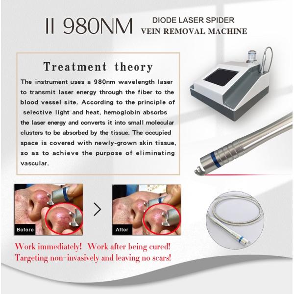 spider veins vascular vein removal nail fungus 980nm diode laser therapy machine for toe nail fungus treatment