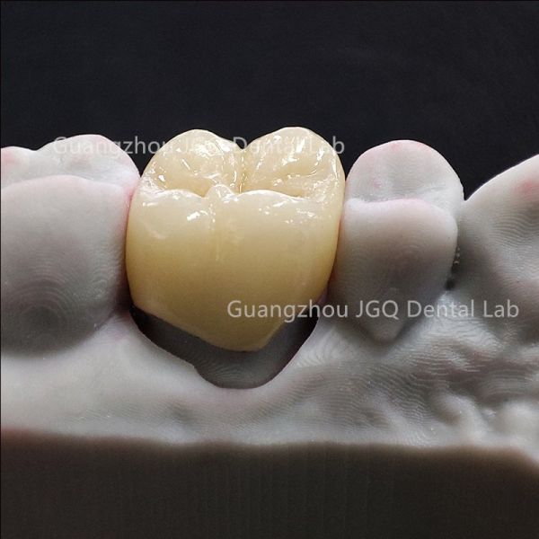 3Shape CAD CAM zirconia milling Guangzhou Dental Lab Custom Layered & Monolithic Zirconia Supply