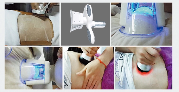 Cellulite Removal Salon Cavitation Rf Vacuum Slimming Beauty Machine