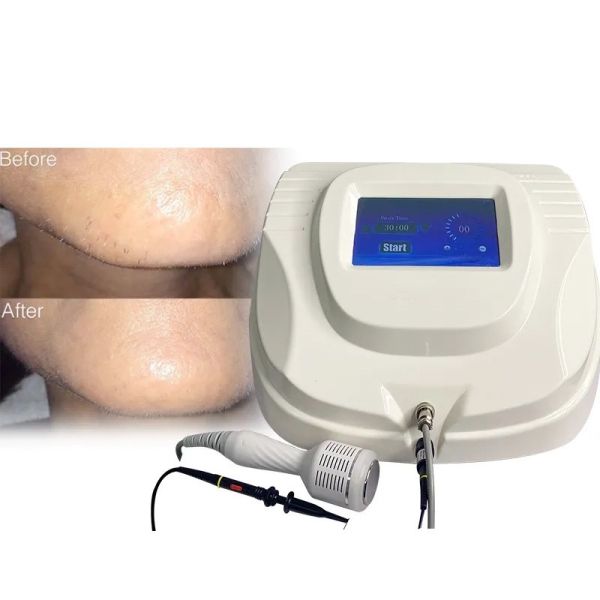 Desktop electrolytic hair removal beauty machine, portable hair removal device, permanent electrolytic hair removal beauty device