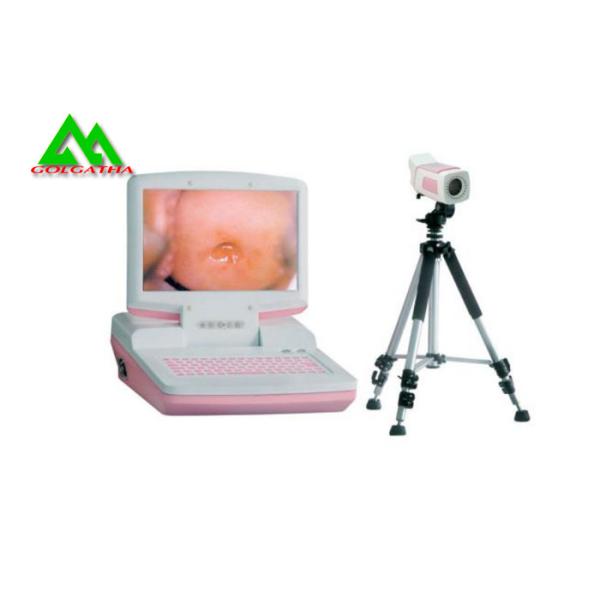 Digital Electronic Colposcope for Gynecological and Obstetrics Purposes
