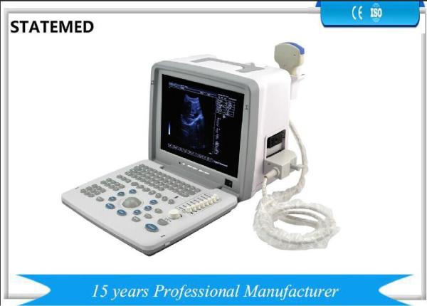 Black White Portable Ultrasound Scanner Equipment For Obstetrics / Gynecology