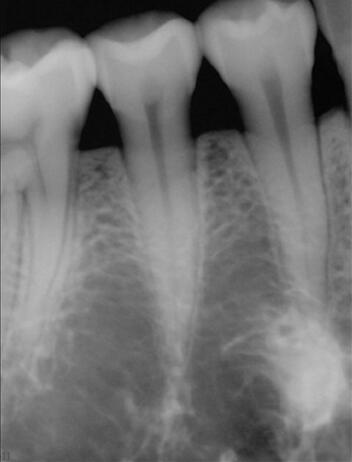 Время 60В удобного Хандхэльд зубоврачебного оборудования цифров кс Рэй регулируемое