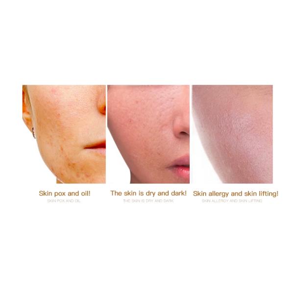 MSDS 50ml Organic Face Serum Gold Flake 5% Hyaluronic Acid