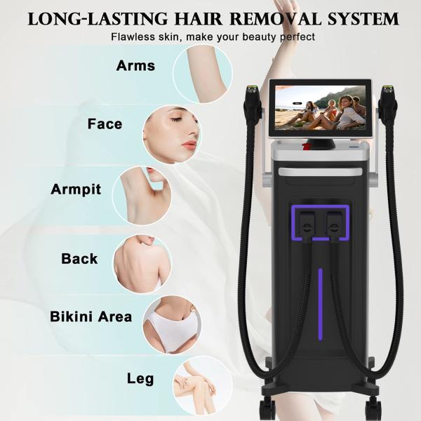 4 Wavelength Ice Platinum Alexandrite Laser Diode Laser 755 808 1064 Tria Beauty Hair Removal Laser 4x Cire Epilation