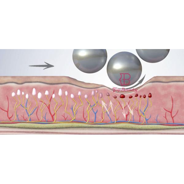 Кожа уменьшения целлюлита тонизируя тело контуря машину терапией