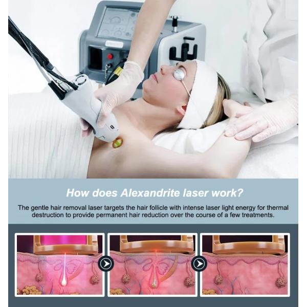 1064 нм длинный импульс Nd Yag лазерная машина сосудистое удаление постоянное удаление волос