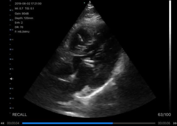 5G Handheld Ultrasound Scanner Convex: 3.5~5MHz, Linear: 7.5~10MHz, Cardiac: 2.5~5MHz