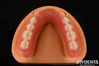 Personalización Dentadura de acrílico acabado ligero Alta elasticidad