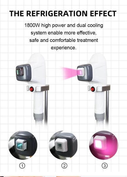 Máquina da remoção do cabelo do laser da fibra para mulheres