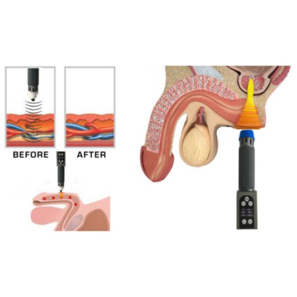 3 в 1 CET ВЫМАЧИВАЮТ облегчение боли оборудования терапией ударной волны физиотерапии Ems Rf Tecar