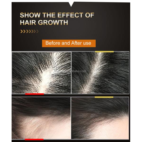 Natural Argan Hair Regrowth Serum Anti Loss With Ginger Essential Oil