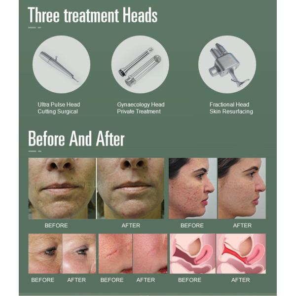 Skin Tightening Clinic Co2 Fractional Laser Machine Air Cooling