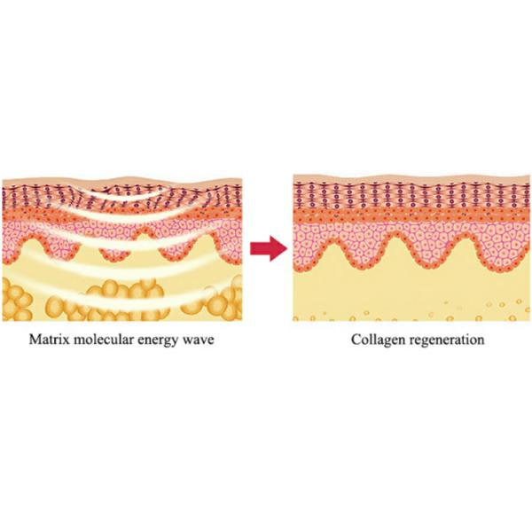 40K de cavitación de vacío presión negativa de masaje de rodillos Velabody máquina de adelgazamiento