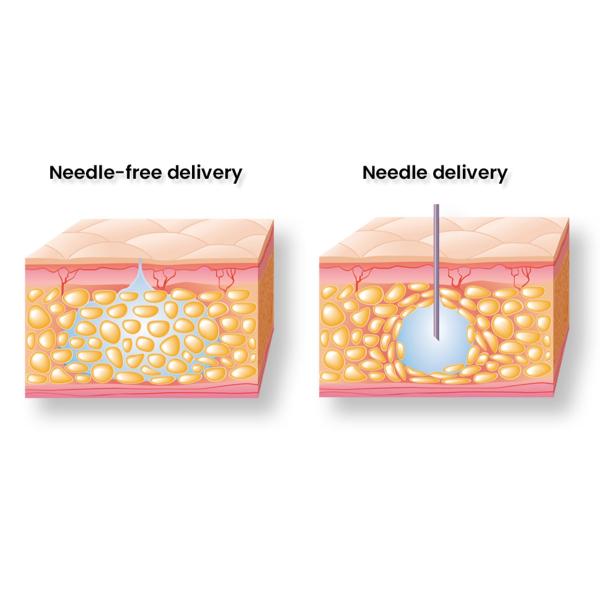 Заполнитель сыворотки HYAMELY Mesotherapy Hyaluronic кисловочный лицевой заполняя