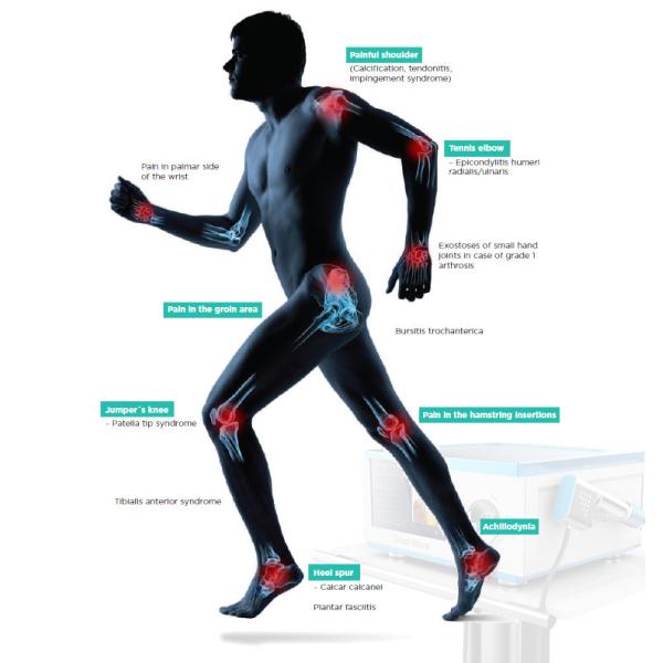 Shock wave therapy equipment ESWT Pain Relief Physical Therapy Equipment Shockwave Equipment