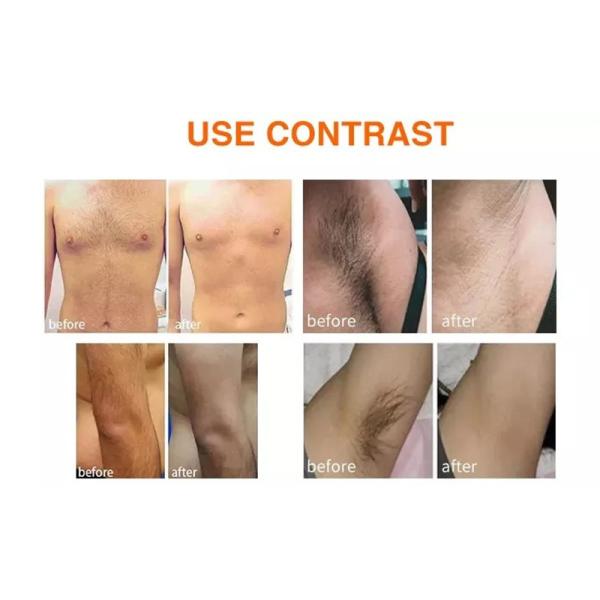 регулируемая машина лазера диода ИМПа ульс 808nm для удаления волос