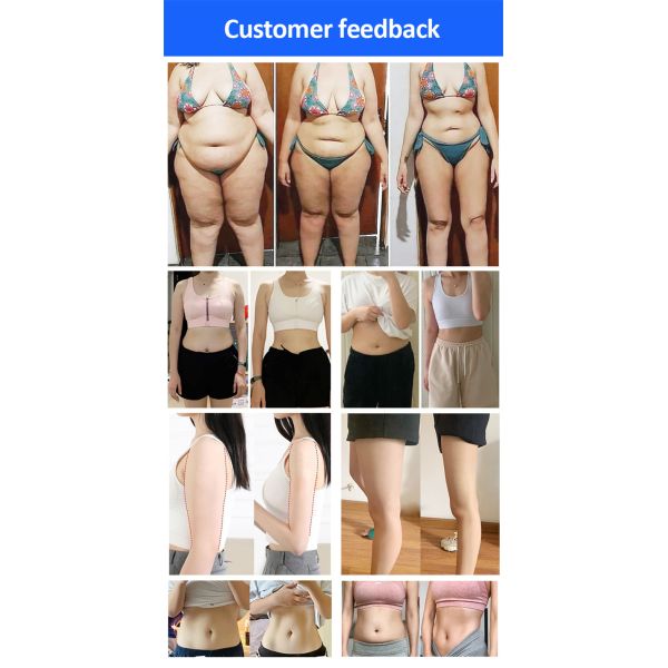 Weight Loss Fast Freezing Cooling Plate EMS Vacuum Cryo Machine