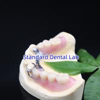 Quadros de dentaduras parciais de metal acrílico Alta estética Laboratório odontológico SDL