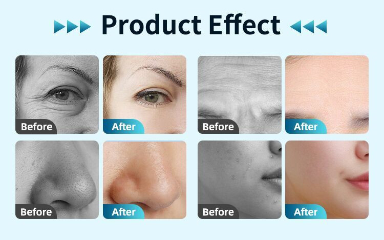 8 In 1 Hydro Oxygen Machine For Salon Facial Skin Care Treatment