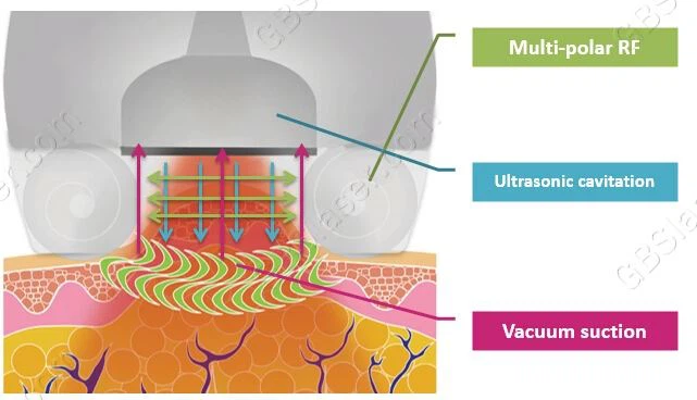 Body Weight Loss Lipo Laser Treatment Fat Removal Machine For Slimming
