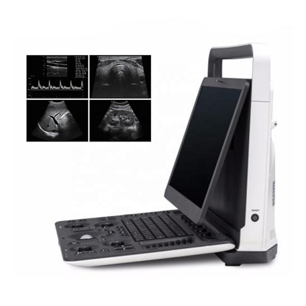 SonoScape E2pro Color Doppler Echo Machine Ultrasound Machine USG with TDI CW PW Function