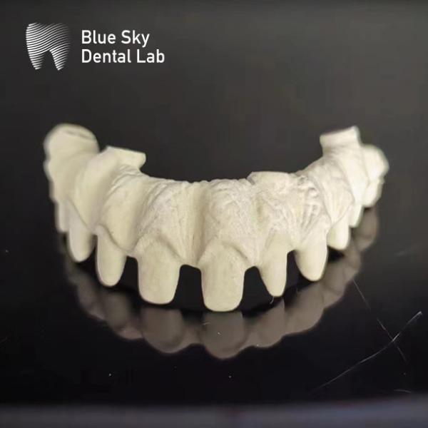 Cadre métallique en titane pur Des ponts dentaires pour l' argent et l' or Couleur du cadre