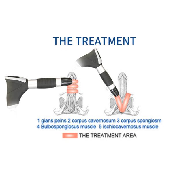 ODM сфокусировал машину Ed терапией ударной волны боль плеча обработки уменьшает