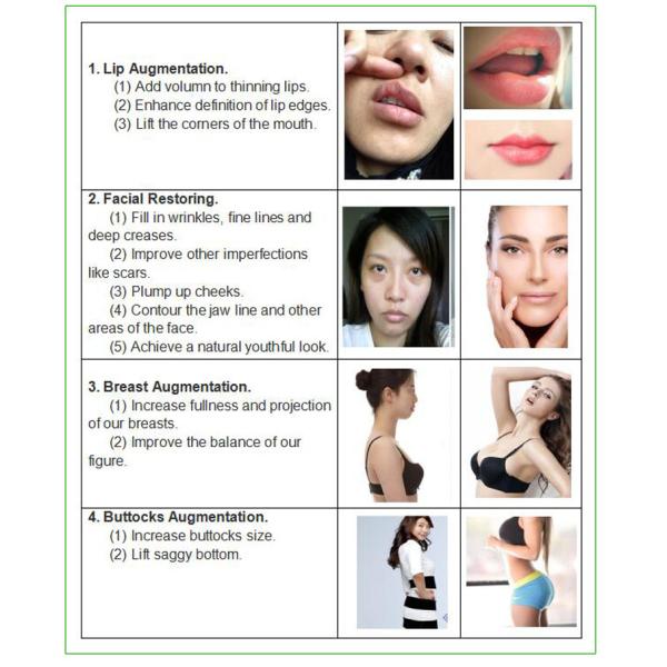 High Quality Beauty Products Hyaluronic Acid Syringe filler