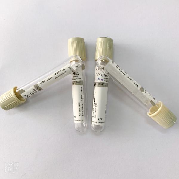 Трубки Вакутайнер плазмы трубки анализа крови стены двойника Когулатион