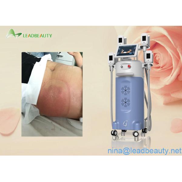 Great weight loss 0kpa-100kpa Vacuum machine cryolipolysis