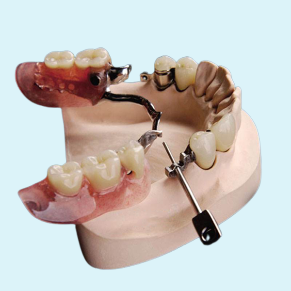Коррозионностойкое Denture приложения точности Mk1 красивое естественное