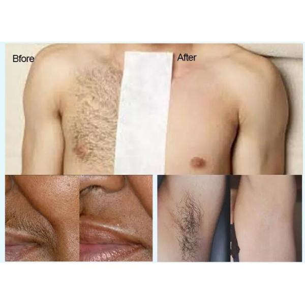 Non Channel Diode Laser Hair Removal Machine , Alexandrite Laser Hair Removal Device