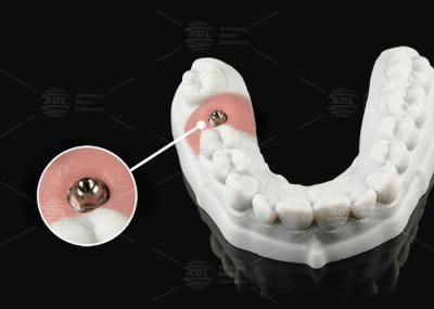 Abutment multiunidade de titânio de prata-ouro para plataforma protética de unidade única ou múltipla