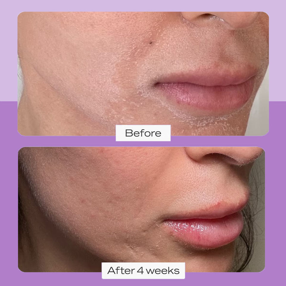 OEM ODM brand organic body and face moisturizing skin care vitamin B5 glycerine aloe shea butter oatmeal repair face cream