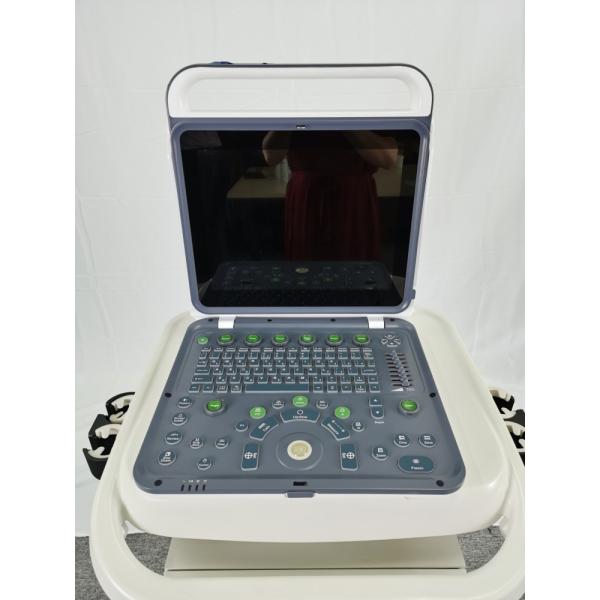 Hospital Outside 2020 New Portable Digital 15 Inch Color Doppler Ultrasound Machine