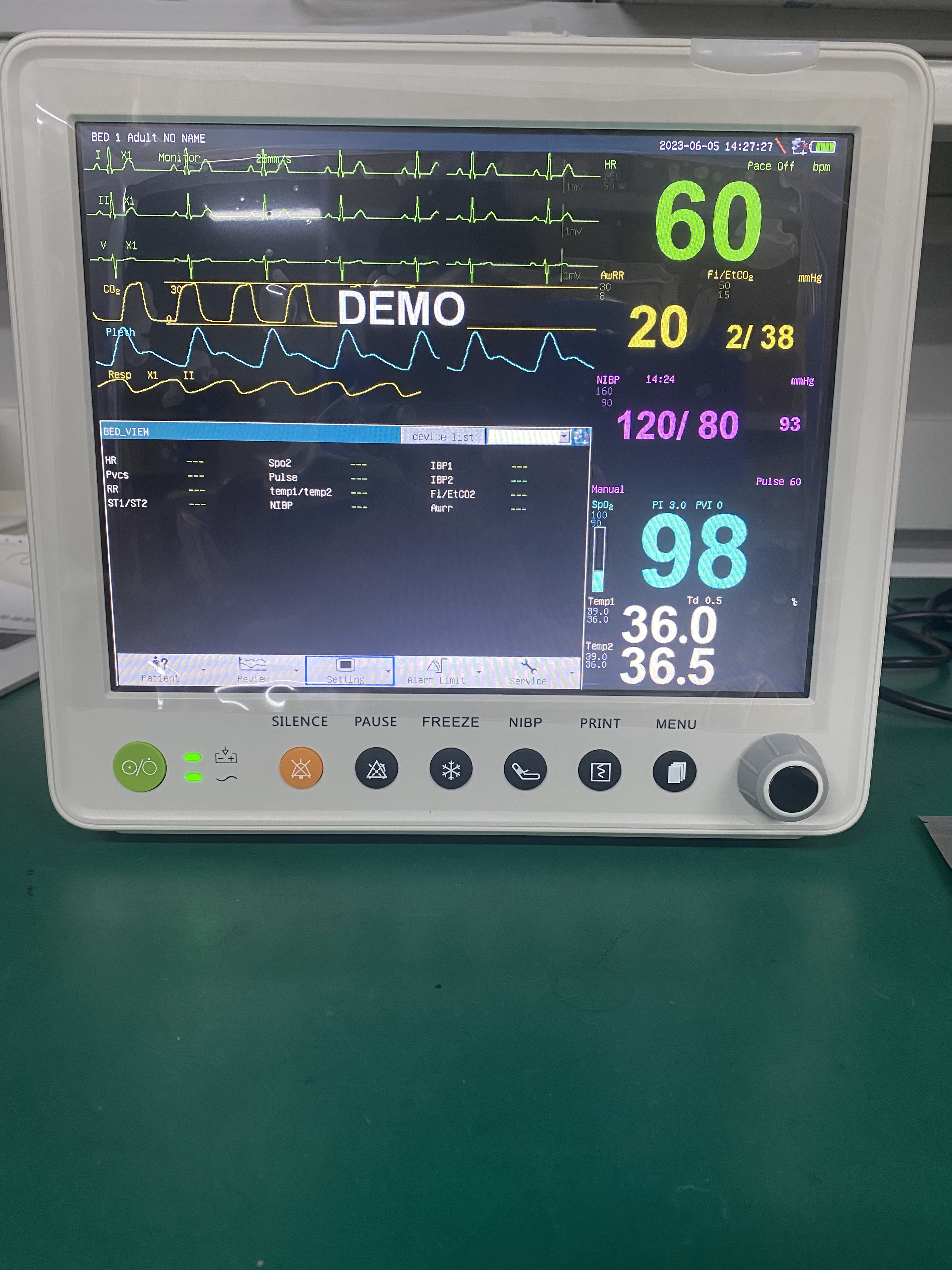 Портативный терпеливый монитор с параметрами PR ETCO2 ECG NIBP SPO2 RESP TEMP