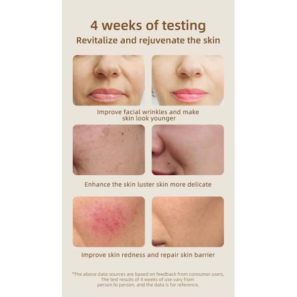 Mascarilla facial de luz LED roja eléctrica para el hogar, silicona, 7 colores, fototerapia LED