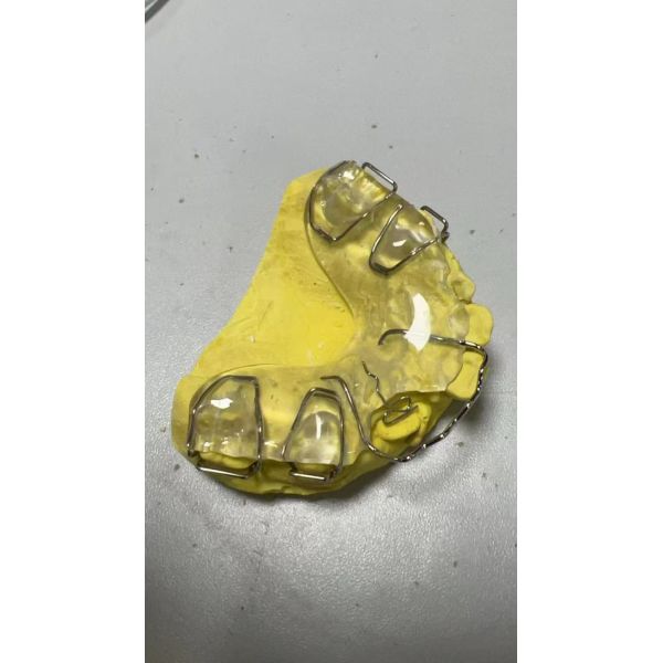 Custom Fit Orthodontic Facemask with Palatal Springs and Adjustable Design
