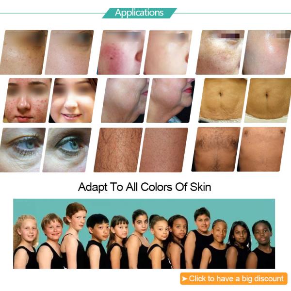 Multi functional Skin Rejuvenation Hair Removal IPL Machine 2000w