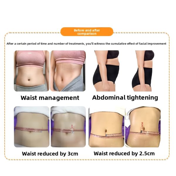 7D HIFU Face And Body Machine , Non Surgical HIFU Skin Tightening Machine