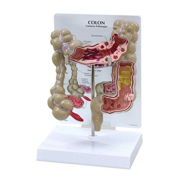 Advanced Medical Human Large Intestine Anatomy Model For School Hospital