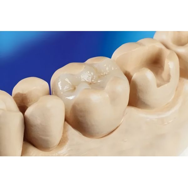 Audental Dental Lab Materials Glass Ceramic Zirconia Block Lithium Disilicate Block Ingot for Dental Restoration