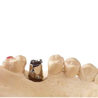 O limite puro de trituração do titânio do processo implanta bom Biocompatibility durável