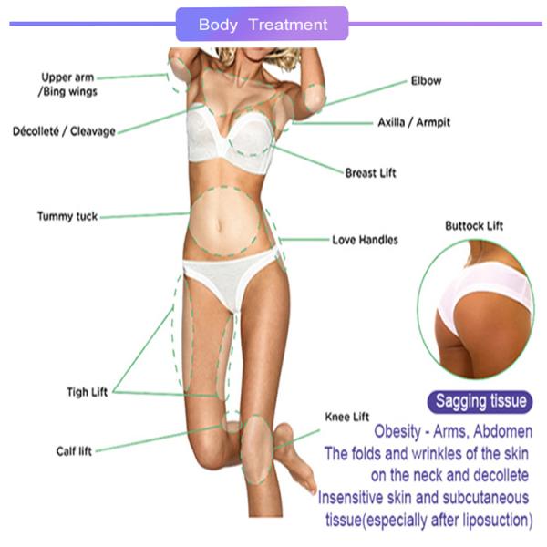 Pdo Tornado Screw Collagen Thread Lift Dermal Use With Moisturizing Function