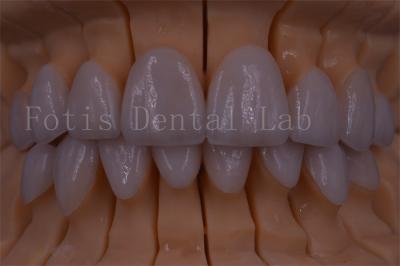 FDA/ISO/CE Certified Digital Crown Teeth Artificial Crown Any Size
