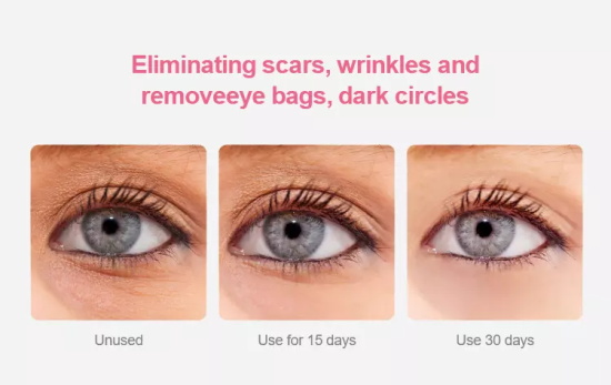 Rechargeable Portable Nano Facial Mister Deep Cleansing Keeping Moisture 13ml Tank