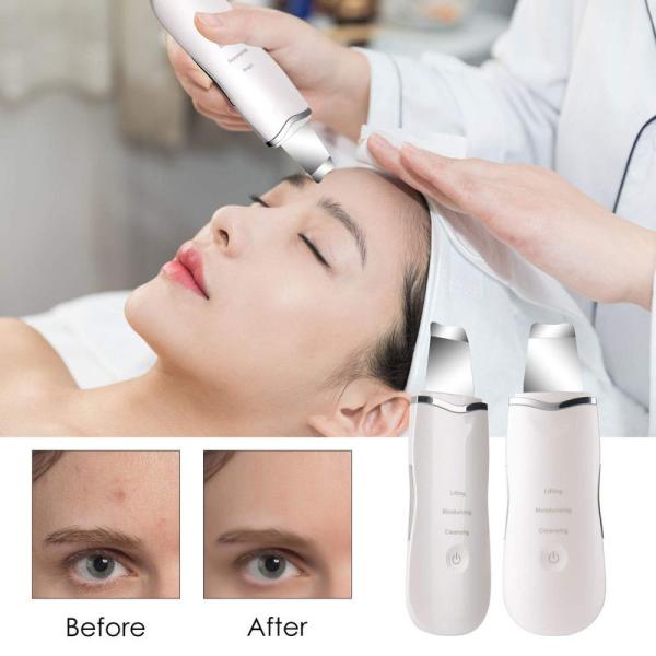 Beauty Salon Facial Skin Ultrasonic Scrubber Electronic Skin Spatula 95g Weight