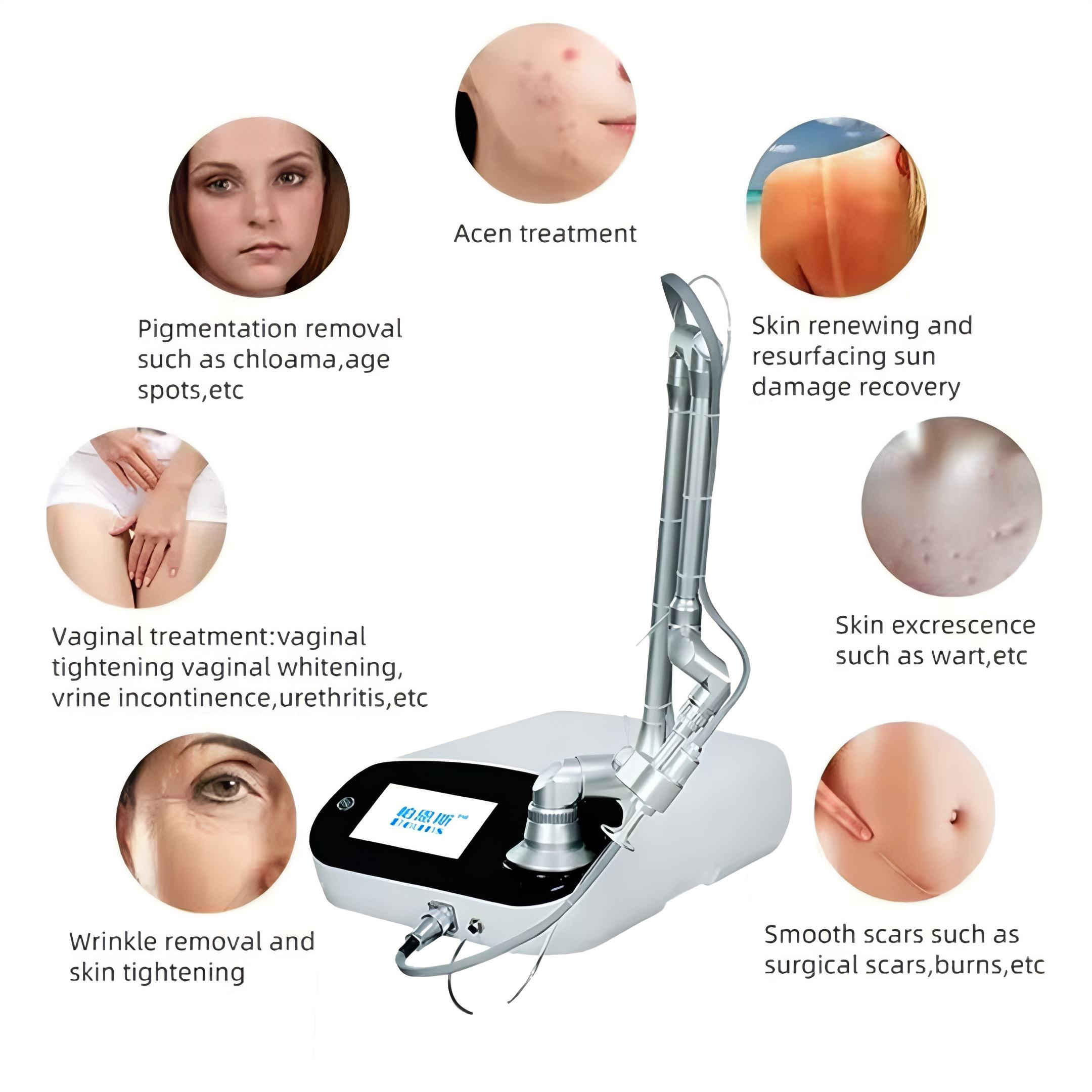 CO2 Fractional Laser Machine for Skin Resurfacing, Acne Scar Removal &Vaginal Rejuvenation