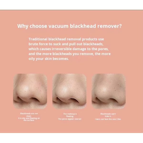 Facial Blackhead Remover Cleaning Device Vacuum Adsorption Technology For Deep Pore Cleansing Effectively Removes Stubborn Blackheads And Whiteheads